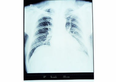 Película olográfica de la proyección de imagen médica, película del ANIMAL DOMÉSTICO X Ray de las impresoras térmicas